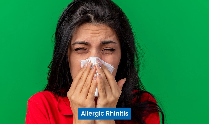 Allergic Rhinitis