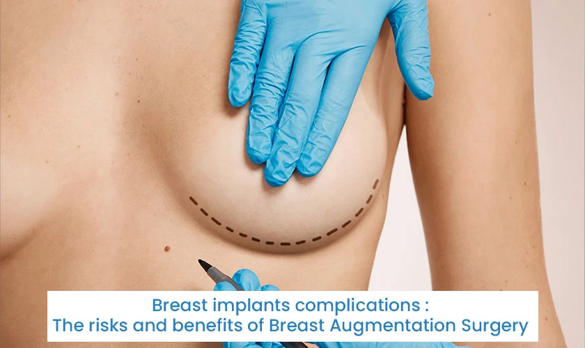 Breast implants complications : The risks and benefits of Breast Augmentation Surgery