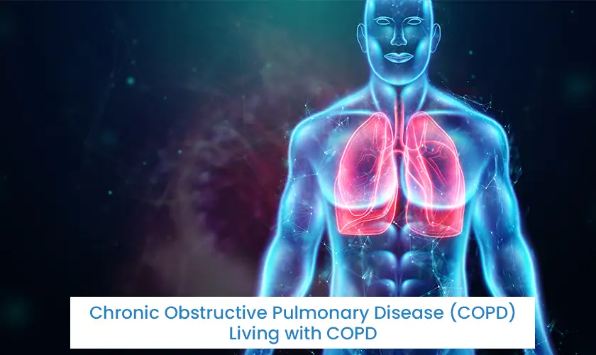 Chronic Obstructive Pulmonary Disease (COPD) – Living with COPD: A Guide to Managing Symptoms and improving Quality of life