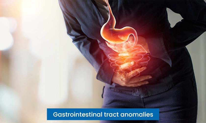 Gastrointestinal Tract Anomalies