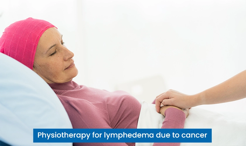 Physiotherapy for lymphedema due to cancer