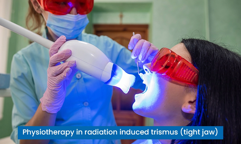 Physiotherapy in radiation induced trismus (Tight Jaw)