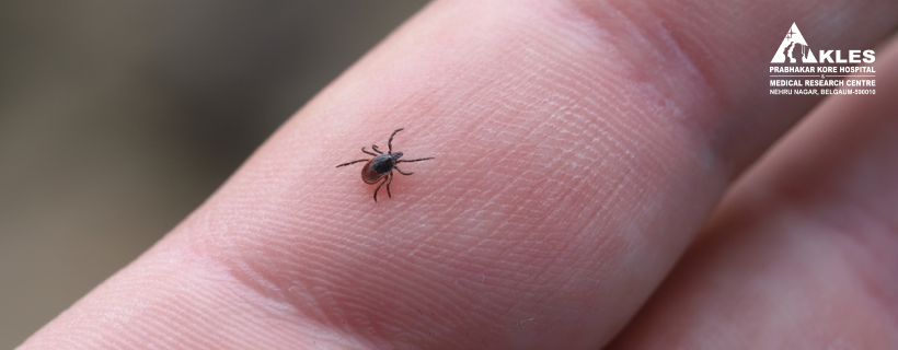Scrub Typhus