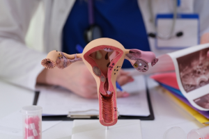 Hydrosalpinx: Causes, Symptoms & Treatment