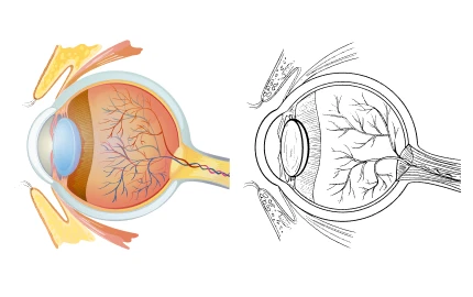 vitreoretina-opthalmology-centre