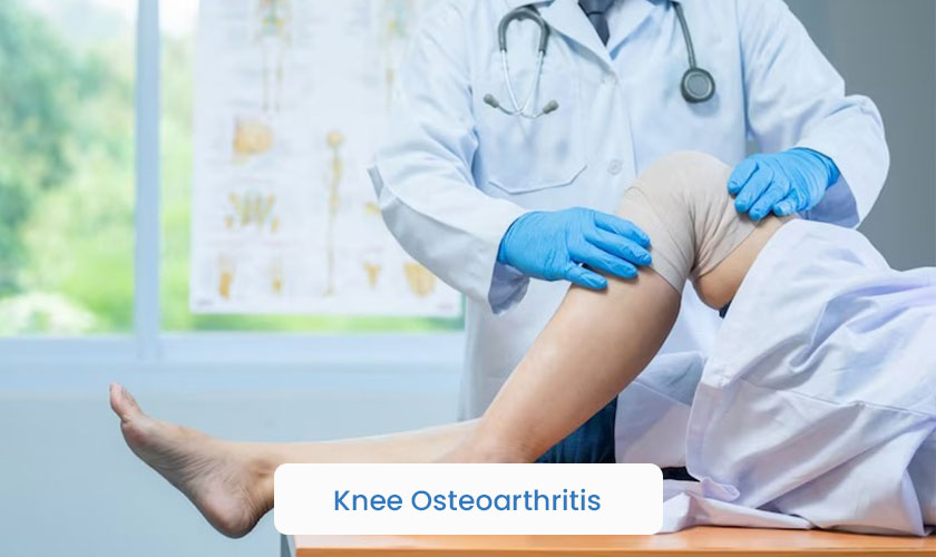 Knee Osteoarthritis - Blog by KLE Hospital
